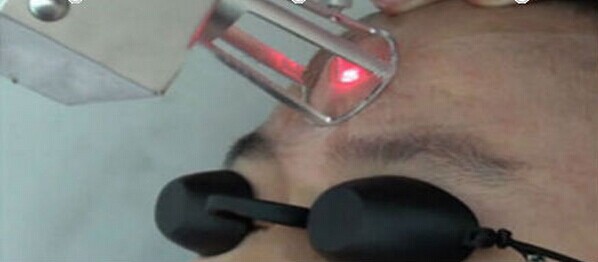 popular rf drive tube medical co2 fractional laser wrinkles removal vaginal tighten & acne remove machine