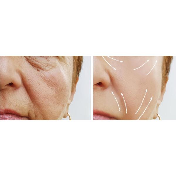 Лицевой поднимаясь Mono винт Tomado потока винта PDO