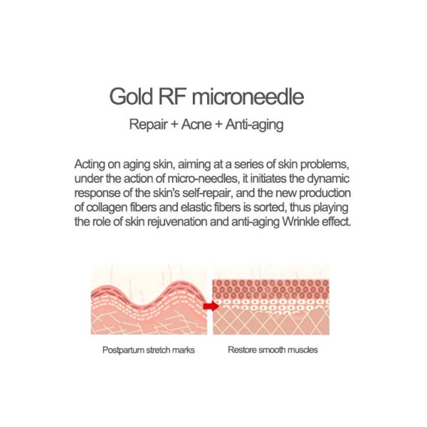 Машина подмолаживания SRF кожи машины Pin RF Microneedling MRF 81