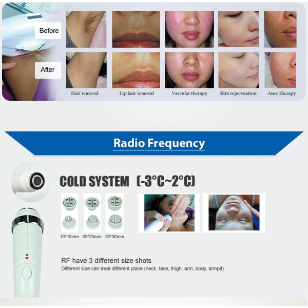 2 IN 1 laser handle + RF handle laser Beauty Machine laser tattoo removal machine Laser mole removal, Multifunctional portable laser beauty machine