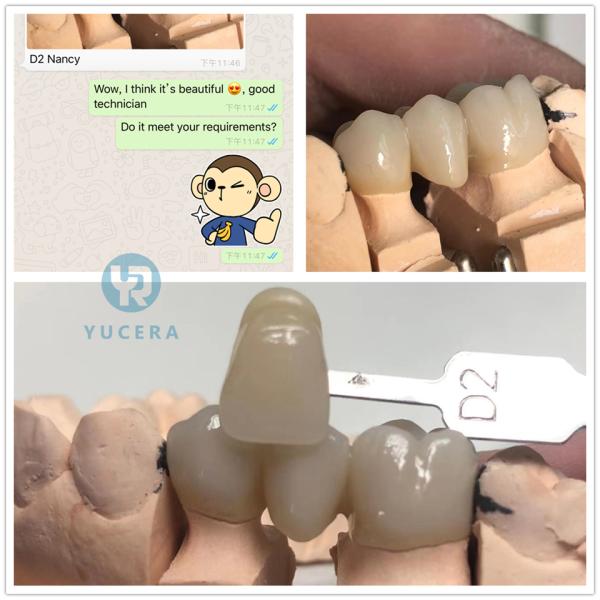 Потребляемые вещества лаборатории блока Zirconia ODM 1200Mpa OEM зубоврачебные