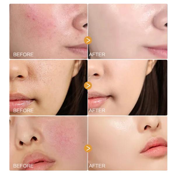 MSDS Facial Skin Care Products Soro de pétalas de camomila orgânico Soro facial natural para pele sensível