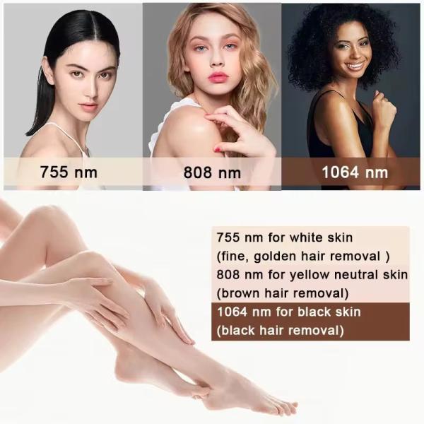 755nm 808nm 1064nm Hair Removal Laser Machine 600W Permanent Hair Removal Device