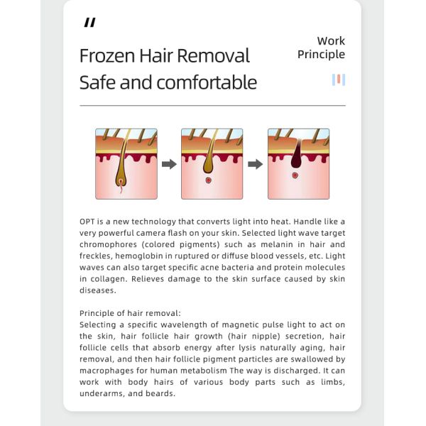 portable Beauty Machine E-light laser removal machine laser hair removal painless with home use beauty salon machine