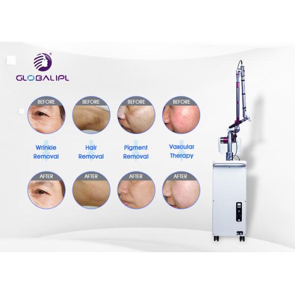 4 Handpieces Portable Laser Tattoo Removal Machine With 1 - 6hz Frequency