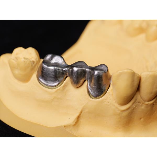 Audental 04 aleación noble de plata-paládio porcelana aleación blanca Pd53.3% para restauraciones dentales de larga duración