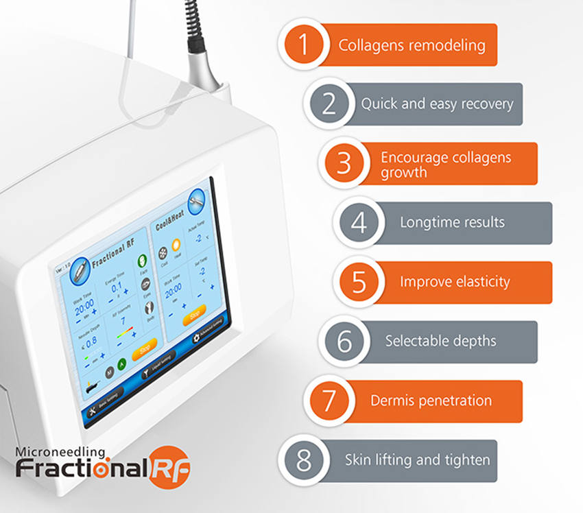 Степень Microneedling Frational RF удаления 45 меток Strectch