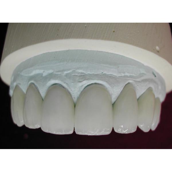 B1 D98*25mm Dental Multilayer 3D Pro Zirconia Milling Disc 700Mpa - 1200Mpa