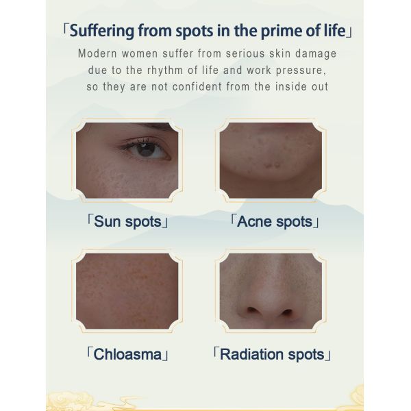 Wholesale Lightening Whitening Anti Freckle Removing Dark Spot Moisturizing Face Melasma Dark Spot Corrector Whitening Cream