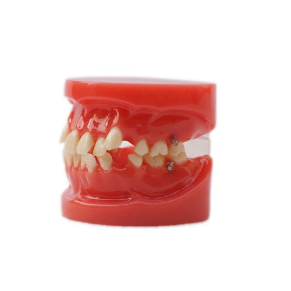 Treinamento Uso de Dentes Dentários Modelo de Ensino Modelo Ortodôntico Dental Funcional Sem Bracket