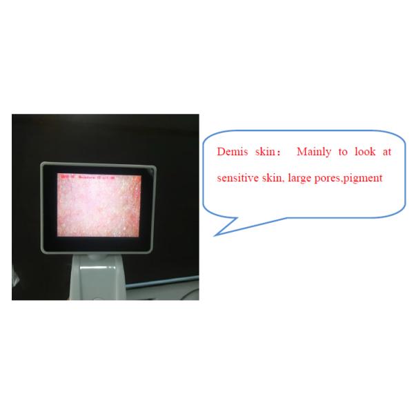 Метр влаги кожи цифров анализатора кожи КЭ БС5СХ цифров для доктора