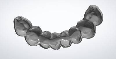 Milled Egg Shell CAD CAM Dental Design For PMMA Temporary Bridge Implant