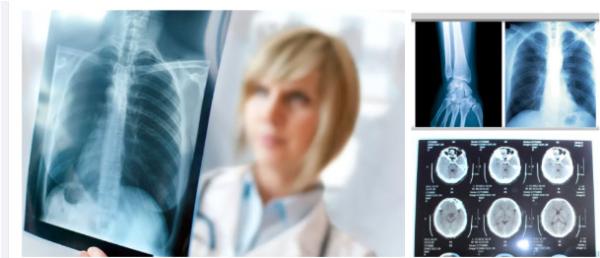 Blue White X Ray Film  for Accurate Diagnostic Imaging