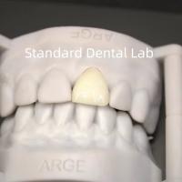 Couronnes de laboratoire dentaire numérique CAD CAM Translucide couronne en zirconium en couches