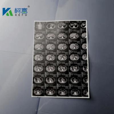 180um A3 White Inkjet Medical X Ray Film Canon Epson Inkjet Printer Film