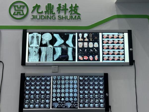 Printing Blue Thermal X Ray Laser Film Medical X Ray Equipments