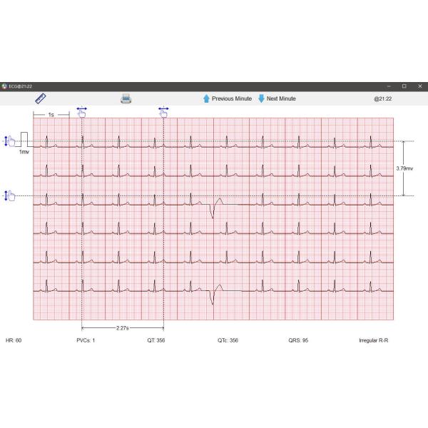 High Accurate Portable Wireless Vital Signs Monitor For Family Clinical Healthcare