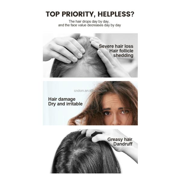 Hair Growth Laser Comb with Frequency Anti Loss Massage and Infrared Advantage 3 in 1