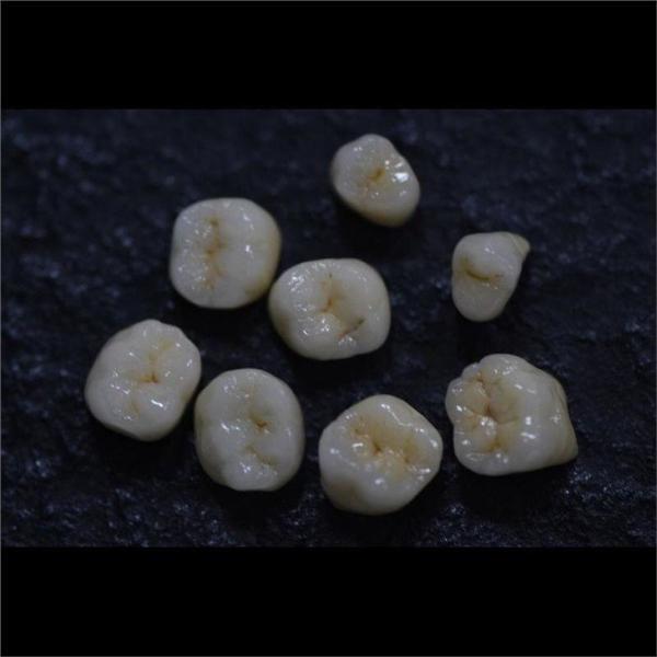 Dentists Cad Cam PFM Crown Ceramic Material Metal Foundation