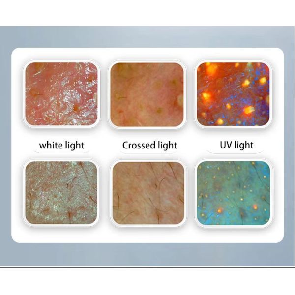 9 Spectrum Intelligence Bacterial Flora Detection 2in1 Scalp Scanner 3D Facial Analyzer