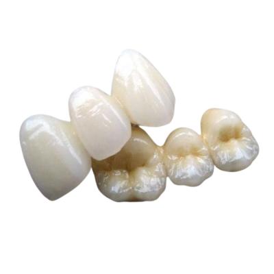 Estabilidade forte do dente da coroa da ponte da porcelana nenhuns sensação do corpo estrangeiro
