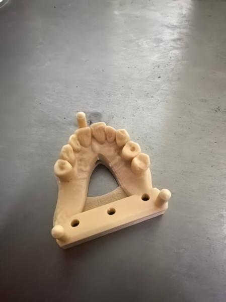 Jaw Model 3D Dental Model Printing Bite Pads Dental Bonding Resin Bonding Teeth Near Me