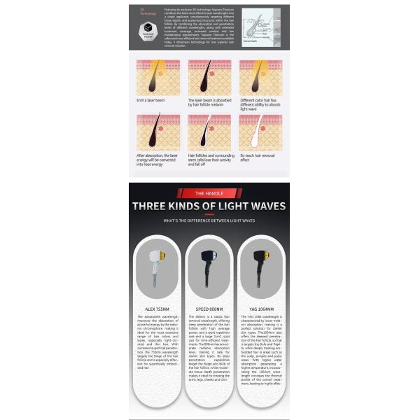 ТЕХНИЧЕСКАЯ машина удаления волос лазера диода 600W 808 для затягивать кожи