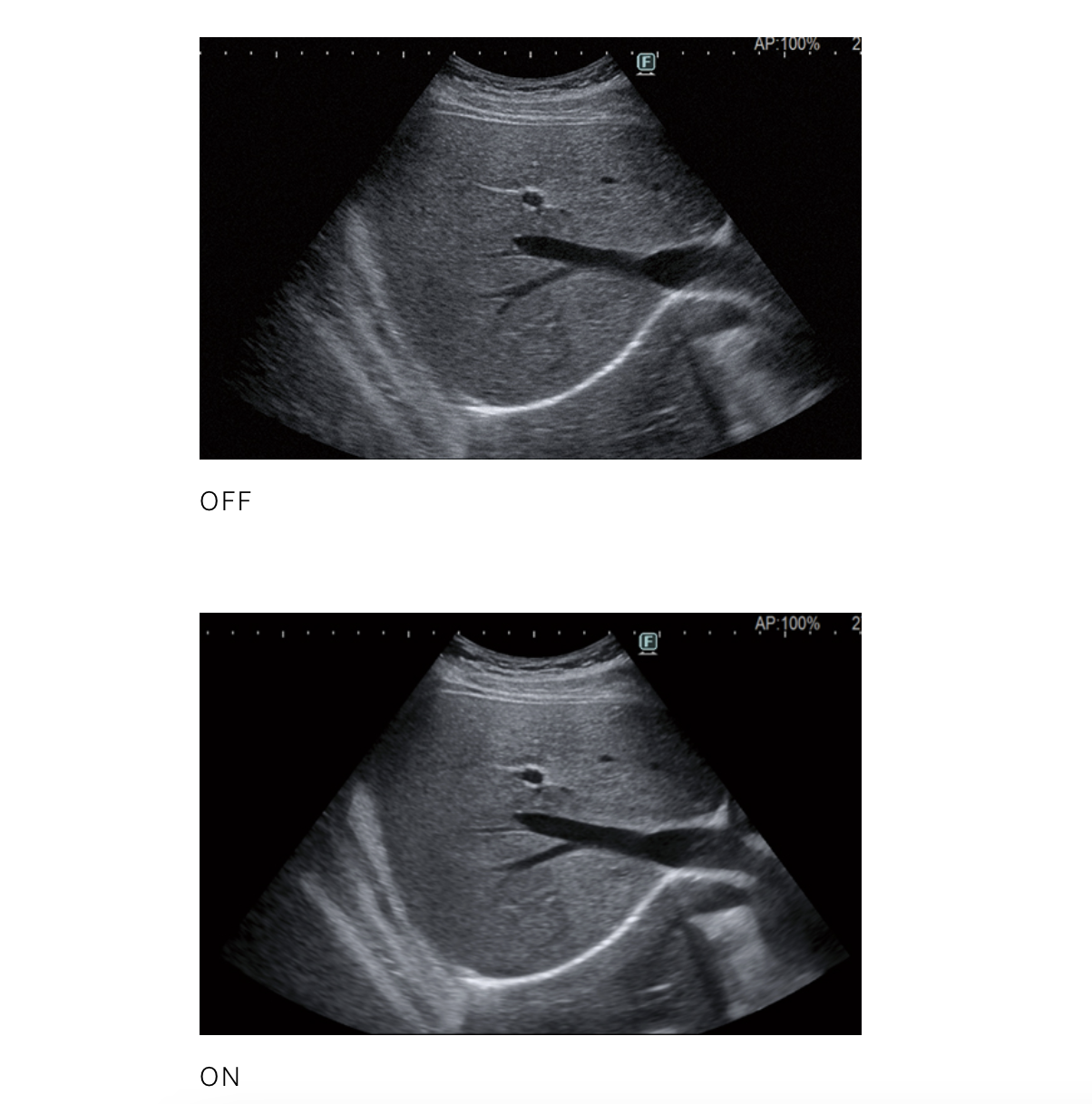 ​Fujifilm ARIETTA 850 Ultrasound System with Pure Symphonic Architecture