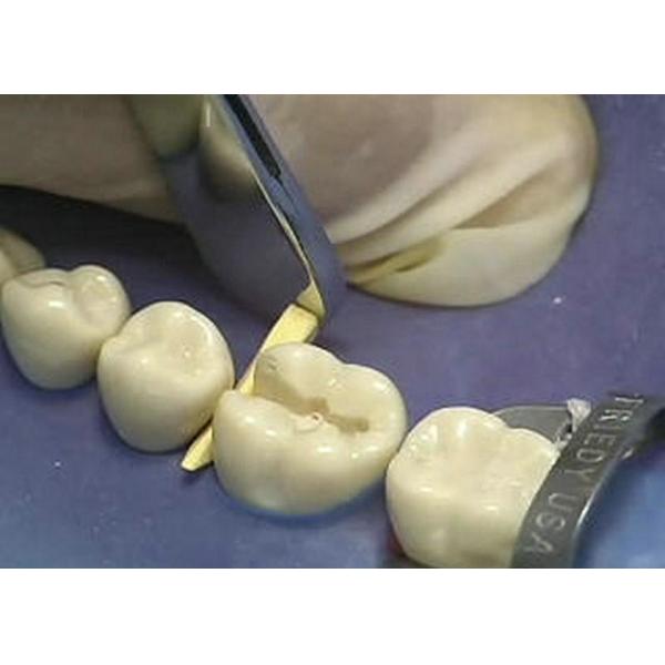 Disposable Dental Sectional Matrix System Wooden Wedges Dental Kit Colorful For Fixing Tooth