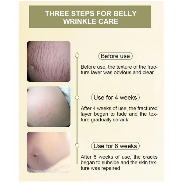 Hidratante natural para embarazo y cuidado de la piel Crema para el vientre, mantequilla para madres lactantes