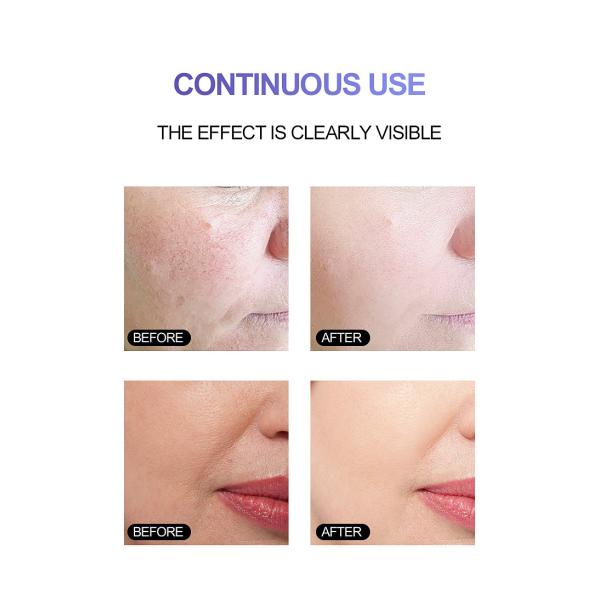 30ML Vitamin C Serum Hyaluronic Acid Collagen 4 In 1 Face Serum For Women