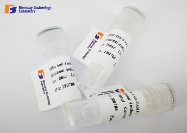 Mouse Anti ENO2 Custom Monoclonal Antibody with NSE Fusion Protein