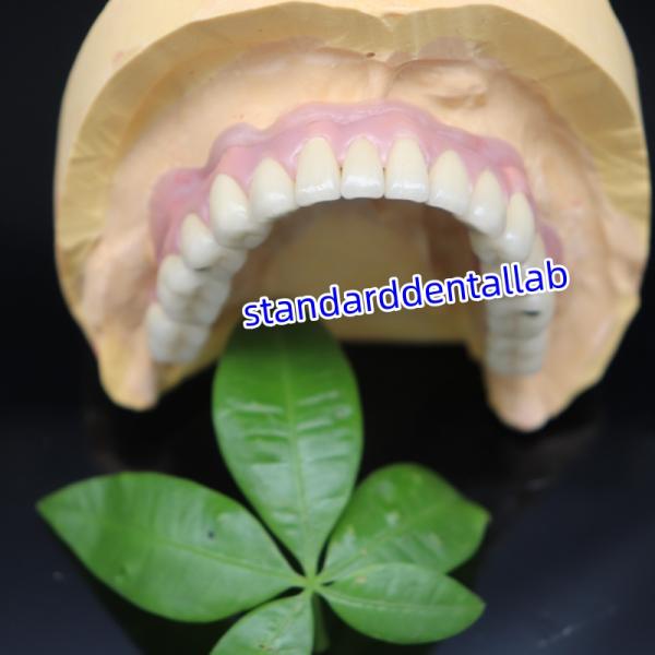 Скрутные зубные имплантаты металлические керамические короны Мост Мало