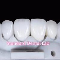 Restaurations à l' apparence naturelle Dentistique à l' aide de la couronne dentaire en zirconium