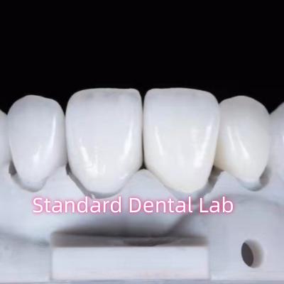 Restaurações de aparência natural Aidite Dental Zirconia Coroa dentária