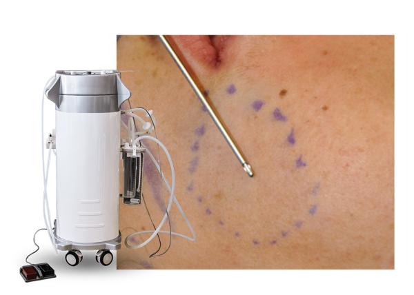 Power Assisted RF Lipo Slimming Machine Weight Loss Equipment AC220V 50Hz