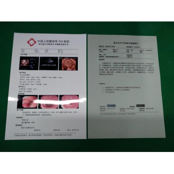 Основанный ЛЮБИМЦЕМ OEM фильма медицинского сухого фильма белый струйный x Рэй 125um 150um 180um