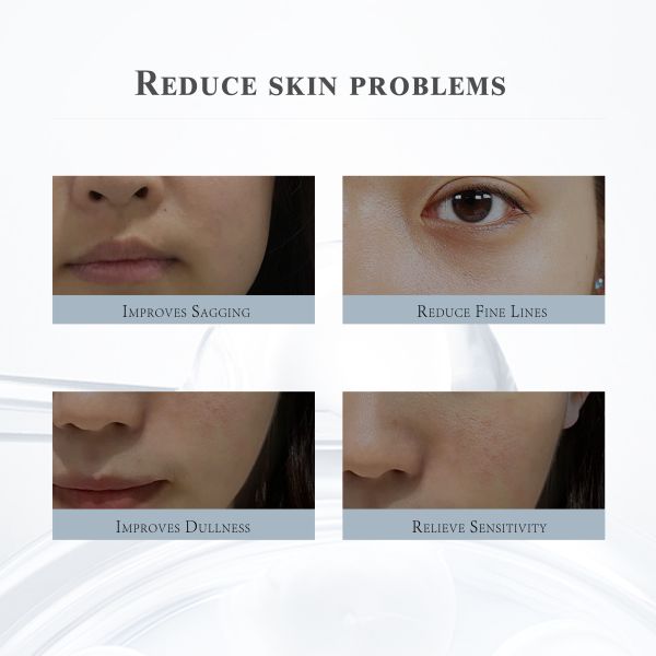 Sheep Placenta Freeze-Dried Serum Peptide Infused Anti-Aging Hyaluronic Acid Facial for Essence Day Night-Factory Custom