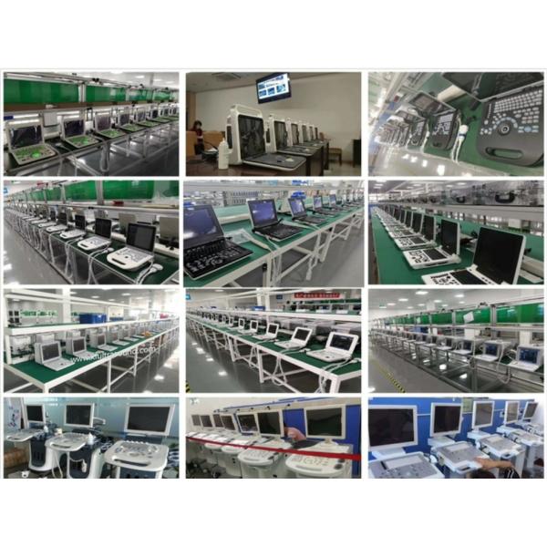 Оборудование LCD ультразвука OEM OB акушерское показывает управление TGC