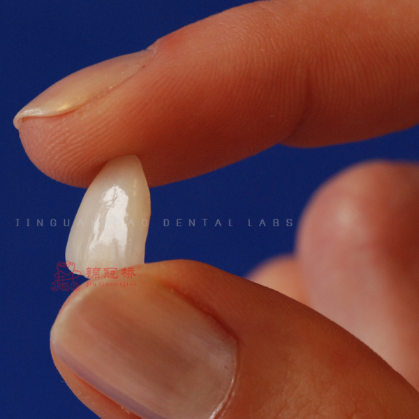 Ivoclar Emax Laminate Veneers High Translucency China Dental Lab