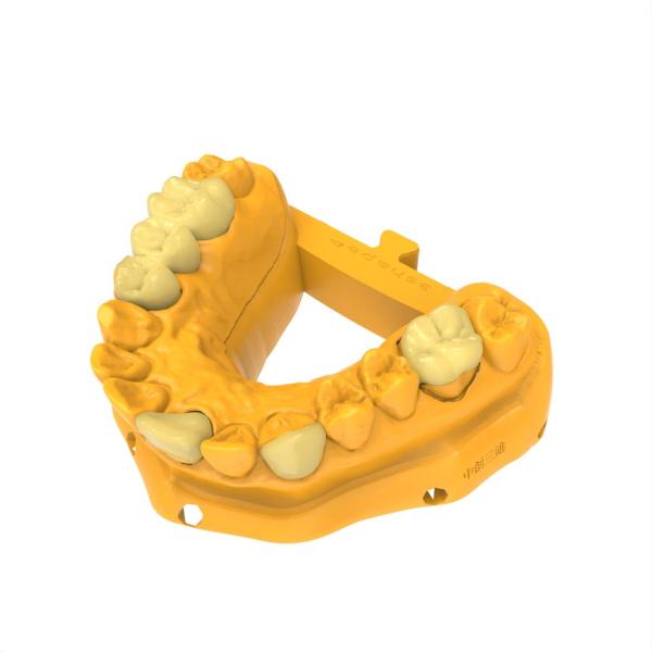 Résine de pont à couronne permanente inodore