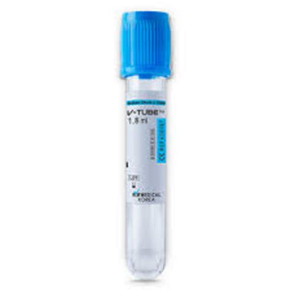 Non Vacuum Blood Collection Lavender Edta Tubes For Sample Collection