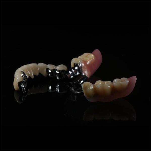 Precision Zirconia PFM Crowns Partial Dentures Natural Looking