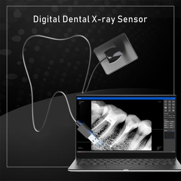 Dental X-Ray Digital Sensor For Dental Implant And Endodontic Treatment