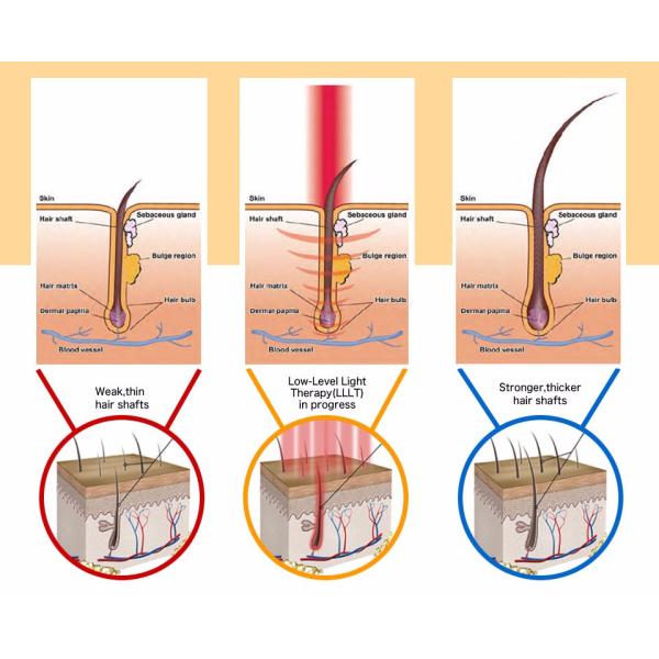 Шлем обработки Regrowth машины роста волос лазера СИД вертикальный фотодинамический