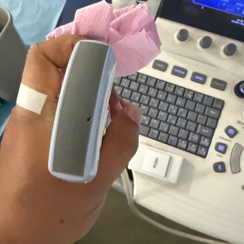GE Ultrasound Probe Repair Service Transducer Lens Change