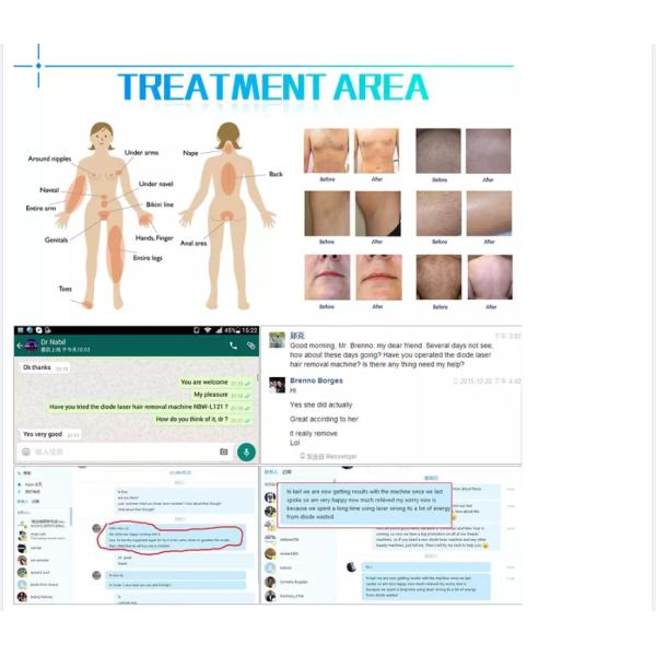 Top 2019 European popular professional aesthetic spa equipment diode laser hair removal machine for sale