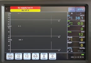 S6200A Anesthesia Ventilator Machine ICU Operation Room Anaesthesia Workstation