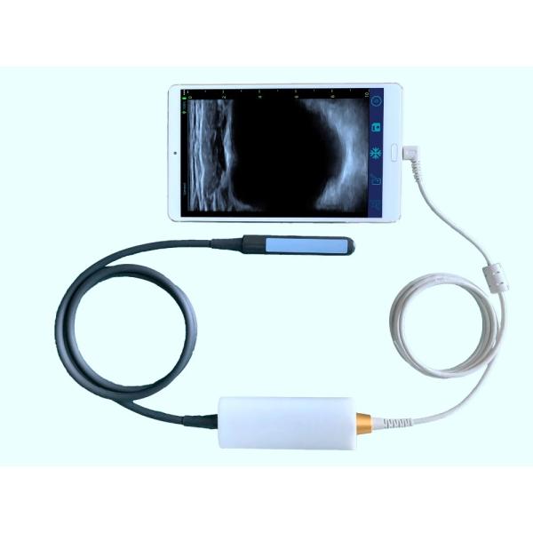 Hot Sale Smart USB Convex Medical Doppler Ultrasound Scanner Ultrasound Probe