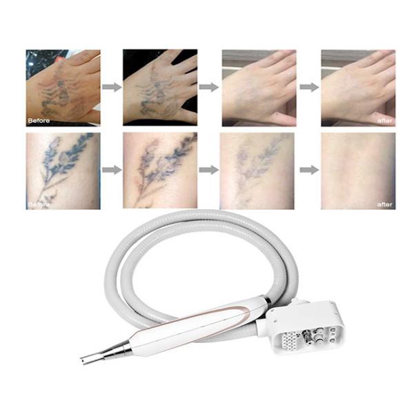 1064Nm 1320Nm 532nm забеливая машину лазера ND YAG